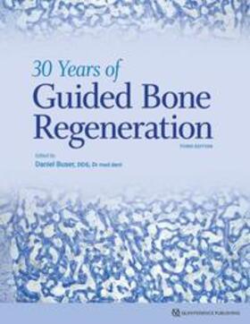 Buser | 30 Years of Guided Bone Regeneration | Buch | 978-0-86715-803-8 | sack.de