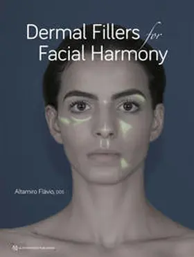Flavio / Flávio |  Dermal Fillers for Facial Harmony | Buch |  Sack Fachmedien