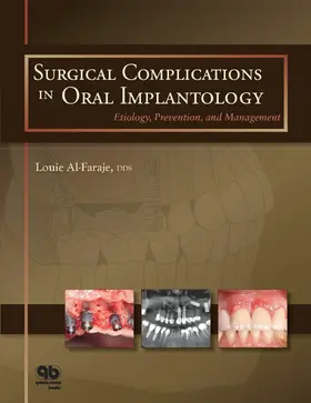 Al-Faraje | Surgical Complications in Oral Implantology | E-Book | www.sack.de