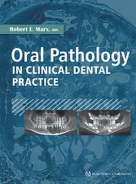 Marx |  Oral Pathology in Clinical Dental Practice | eBook | Sack Fachmedien