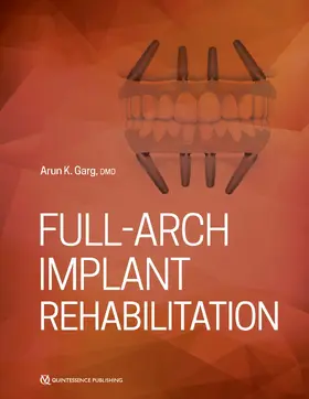 Garg |  Full-Arch Implant Rehabilitation | eBook | Sack Fachmedien