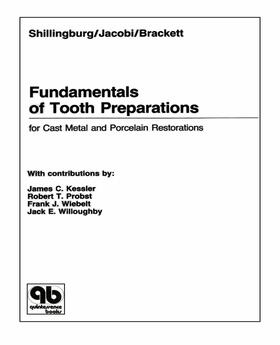 Shillingburg / Jacobi / Brackett | Fundamentals of Tooth Preparations for Cast Metal and Porcelain Restorations | E-Book | sack.de