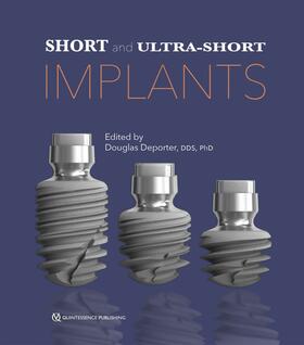 Deporter | Short and Ultra-Short Implants | E-Book | sack.de