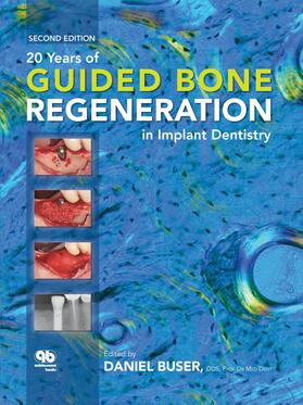 Buser | 20 Years of Guided Bone Regeneration in Implant Dentistry | E-Book | sack.de