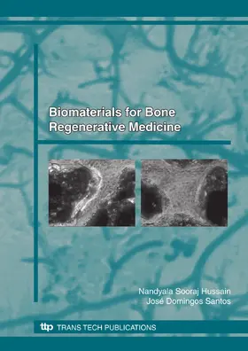Sooraj Hussain / Santos | Biomaterials for Bone, Regenerative Medicine | Buch | 978-0-87849-153-7 | sack.de