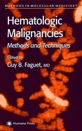 Faguet |  Hematologic Malignancies | Buch |  Sack Fachmedien