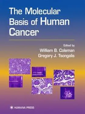 Coleman / Tsongalis | The Molecular Basis of Human Cancer | Buch | 978-0-89603-634-5 | sack.de