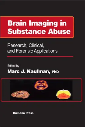 Kaufman |  Brain Imaging in Substance Abuse | Buch |  Sack Fachmedien