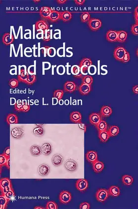 Doolan |  Malaria Methods and Protocols | Buch |  Sack Fachmedien