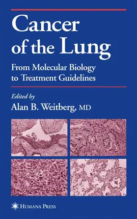 Weitberg |  Cancer of the Lung | Buch |  Sack Fachmedien