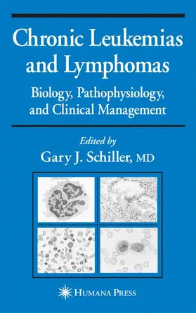 Schiller |  Chronic Leukemias and Lymphomas | Buch |  Sack Fachmedien