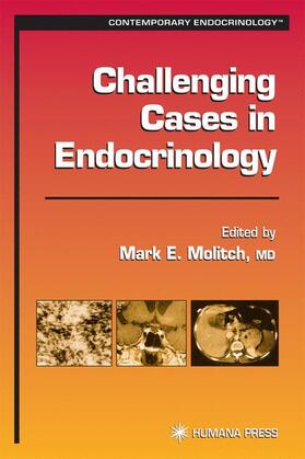 Molitch |  Challenging Cases in Endocrinology | Buch |  Sack Fachmedien