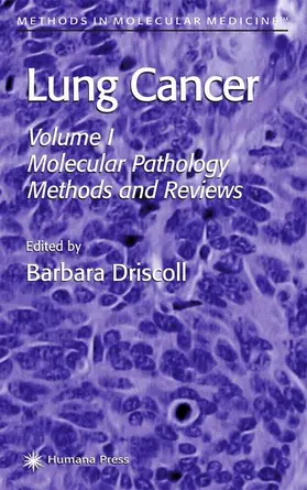 Driscoll |  Lung Cancer | Buch |  Sack Fachmedien