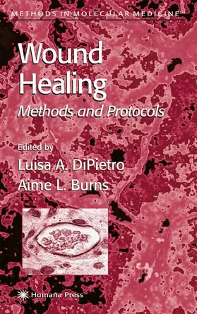 DiPietro / Burns |  Wound Healing | Buch |  Sack Fachmedien