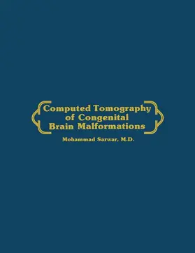 Sarwar |  Computed Tomography of Congenital Brain Malformations | Buch |  Sack Fachmedien