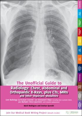 Rodrigues / Qureshi | Unofficial Guide to Radiology | Buch | 978-0-9571499-4-6 | sack.de