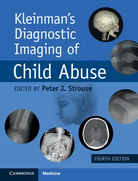 Strouse | Kleinman's Diagnostic Imaging of Child Abuse | Buch | 978-1-009-09805-2 | www.sack.de