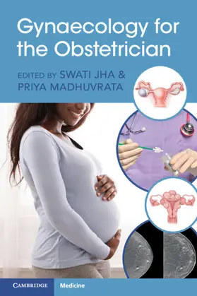 Jha / Madhuvrata |  Gynaecology for the Obstetrician | Buch |  Sack Fachmedien