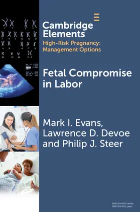Evans / Devoe / Steer |  Fetal Compromise in Labor | Buch |  Sack Fachmedien