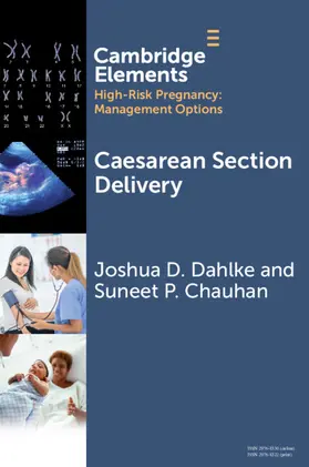 Dahlke / Chauhan |  Caesarean Section Delivery | Buch |  Sack Fachmedien