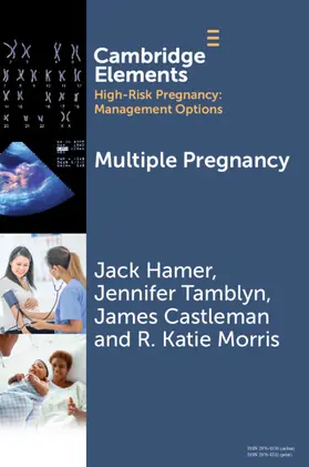 Hamer / Tamblyn / Castleman |  Multiple Pregnancy | Buch |  Sack Fachmedien