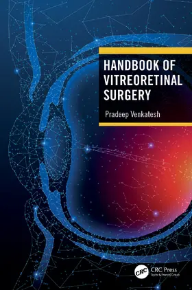 Venkatesh |  Handbook of Vitreoretinal Surgery | Buch |  Sack Fachmedien