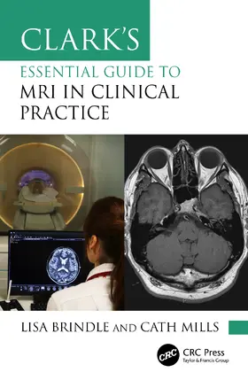 Mills / Brindle |  Clark's Essential Guide to MRI in Clinical Practice | Buch |  Sack Fachmedien
