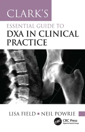 Field / Powrie |  Clark's Essential Guide to DXA in Clinical Practice | Buch |  Sack Fachmedien