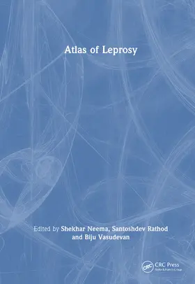 Neema / Rathod / Vasudevan |  Atlas of Leprosy | Buch |  Sack Fachmedien