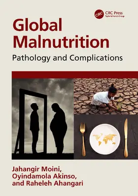 Moini / Akinso / Ahangari |  Global Malnutrition | Buch |  Sack Fachmedien