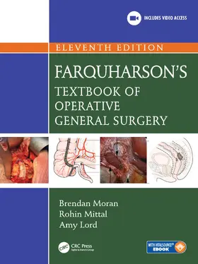 Lord / Moran / Mittal |  Farquharson's Textbook of Operative General Surgery | Buch |  Sack Fachmedien