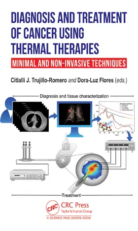 J. Trujillo Romero / Flores |  Diagnosis and Treatment of Cancer using Thermal Therapies | Buch |  Sack Fachmedien