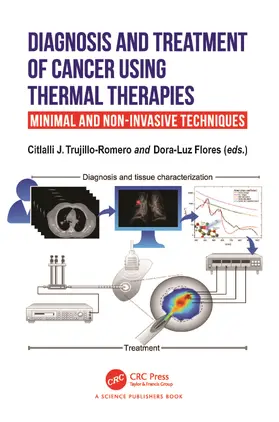J. Trujillo Romero / Flores |  Diagnosis and Treatment of Cancer using Thermal Therapies | Buch |  Sack Fachmedien