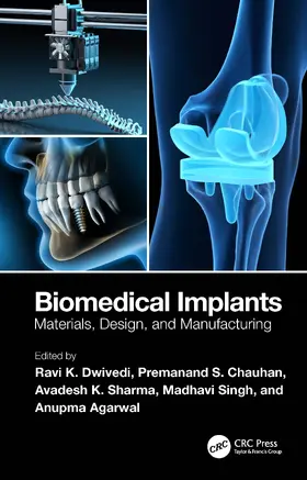 Agarwal / Dwivedi / Sharma |  Biomedical Implants | Buch |  Sack Fachmedien