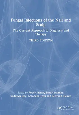 Baran / Haneke / Hay |  Fungal Infections of the Nail and Scalp | Buch |  Sack Fachmedien
