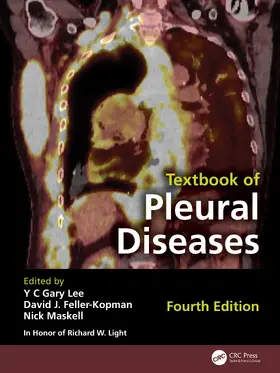 Lee / Feller- Kopman / Maskell |  Textbook of Pleural Diseases | Buch |  Sack Fachmedien