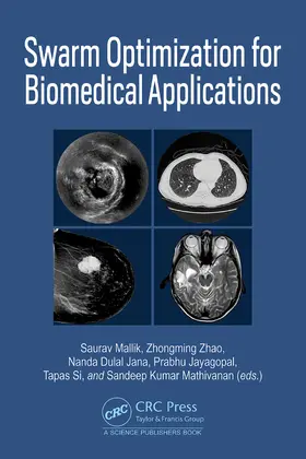 Mallik / Zhao / Jana |  Swarm Optimization for Biomedical Applications | Buch |  Sack Fachmedien
