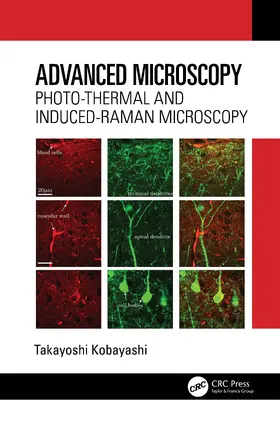 Kobayashi | Advanced Microscopy | Buch | 978-1-032-75886-2 | www.sack.de