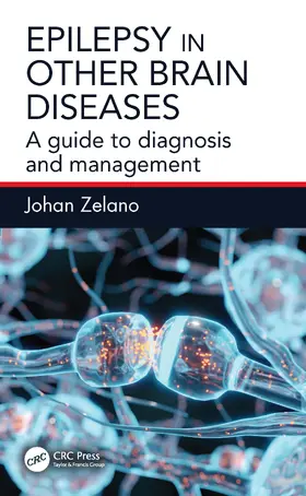 Zelano | Epilepsy in Other Brain Diseases | Buch | 978-1-032-81521-3 | www.sack.de