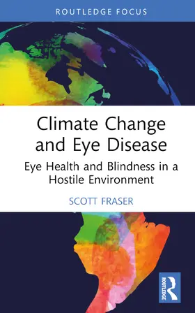 Fraser |  Climate Change and Eye Disease | Buch |  Sack Fachmedien