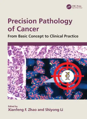 F. Zhao / Li |  Precision Pathology of Cancer | Buch |  Sack Fachmedien
