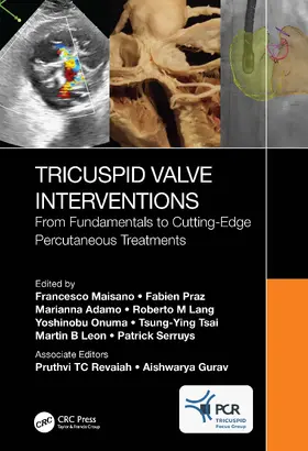 Maisano / Praz / Adamo |  Tricuspid Valve Interventions | Buch |  Sack Fachmedien