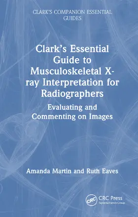 Martin |  Clark's Essential Guide to Preliminary Clinical Evaluation of Musculoskeletal X-rays | Buch |  Sack Fachmedien