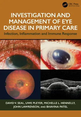 Seal / Pleyer / Hennelly |  Investigation & Management of Eye Disease in Primary Care | Buch |  Sack Fachmedien