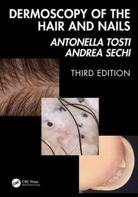 Tosti / Sechi |  Dermoscopy of the Hair and Nails 3e | Buch |  Sack Fachmedien
