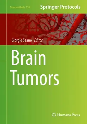 Seano |  Brain Tumors | Buch |  Sack Fachmedien