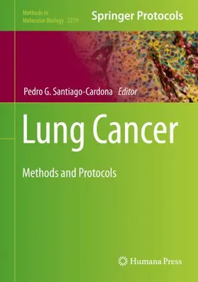 Santiago-Cardona |  Lung Cancer | Buch |  Sack Fachmedien
