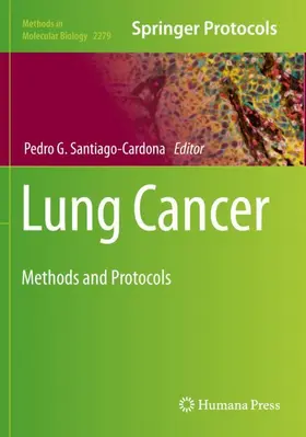 Santiago-Cardona |  Lung Cancer | Buch |  Sack Fachmedien