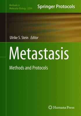 Stein | Metastasis | Buch | 978-1-07-161349-8 | sack.de