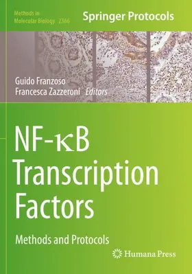 Zazzeroni / Franzoso |  NF-¿B Transcription Factors | Buch |  Sack Fachmedien